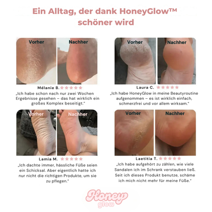 HoneyGlow™ - Beauty-Set für Füße